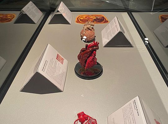 Wycieczka na wystawę Body Worlds