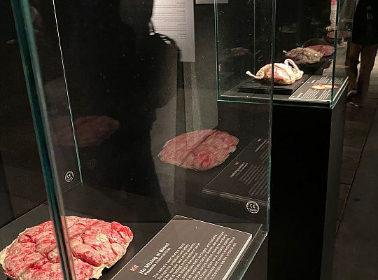 Wycieczka na wystawę Body Worlds